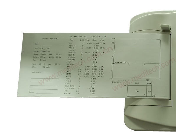 Spirometer printing report by built-in printer of SpirOx pro