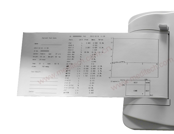SpirOx pro Spirometer print report pulsklockorspirometerosspirometrNeumoloxíaSpirometrSpirometerspirometerNeumologíaEspirómetroSpirometriaSpiromètreSpirométrieספירומטרSpirometriaSpirometroCompliance polmonareСпирометрияСпирометрСпірометрія