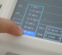 EKG6012